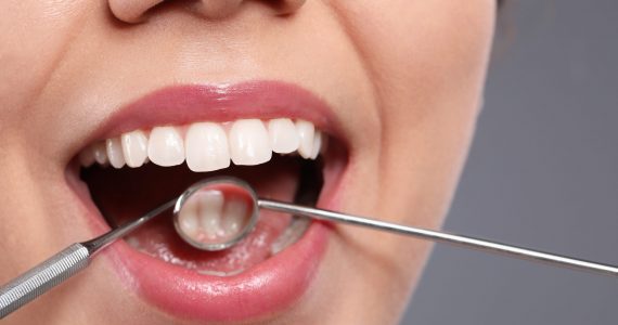 Examining woman's teeth with dentist's mirror on grey background, closeup