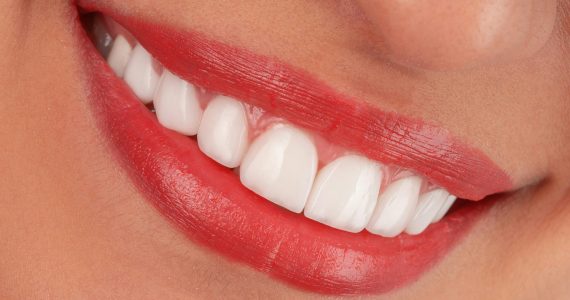 close up of woman smiling teeth